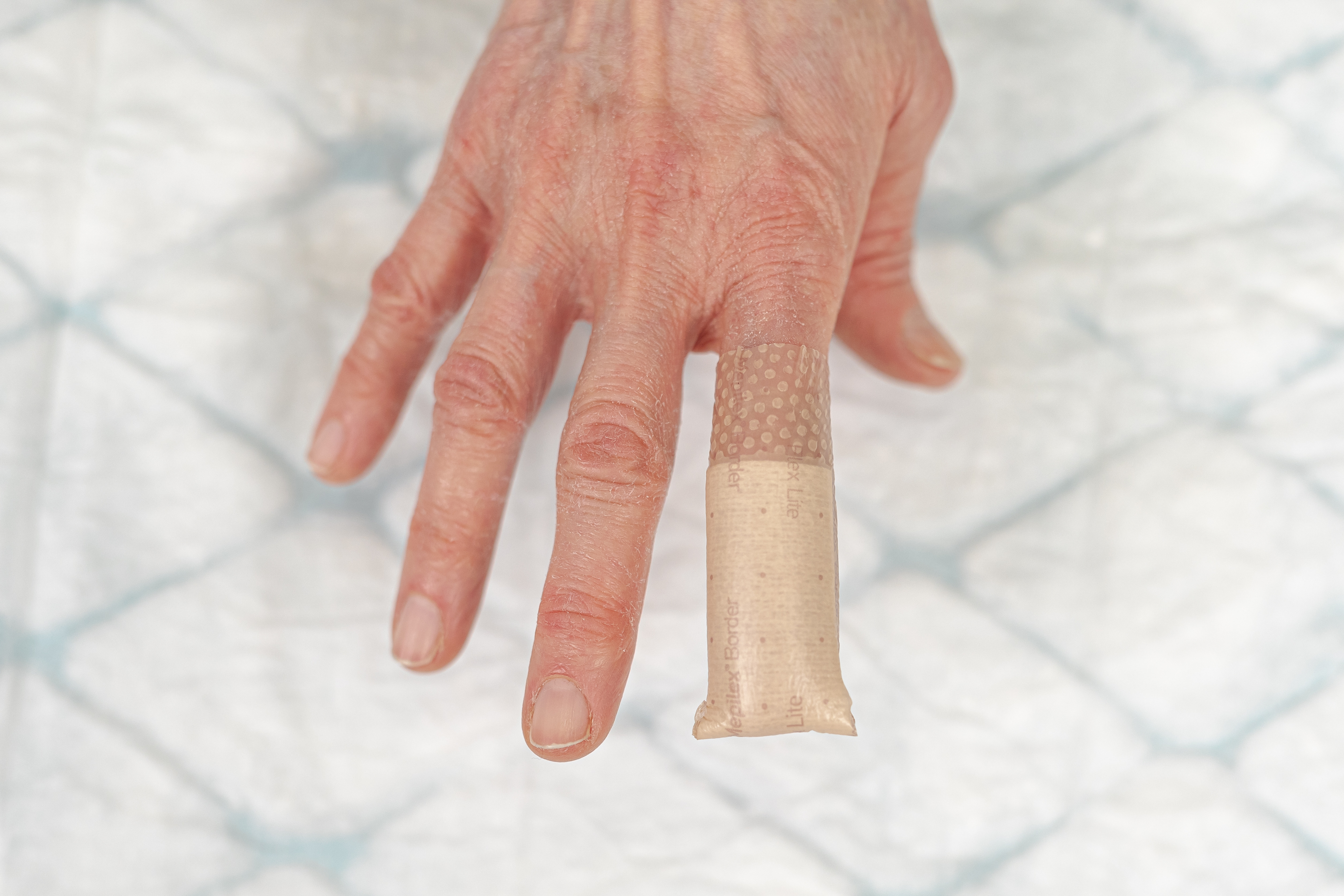 Mepilex Border Flex Lite 5x12,5 cm