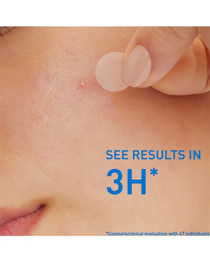 CeraVe Blemish Control Barrier Patches