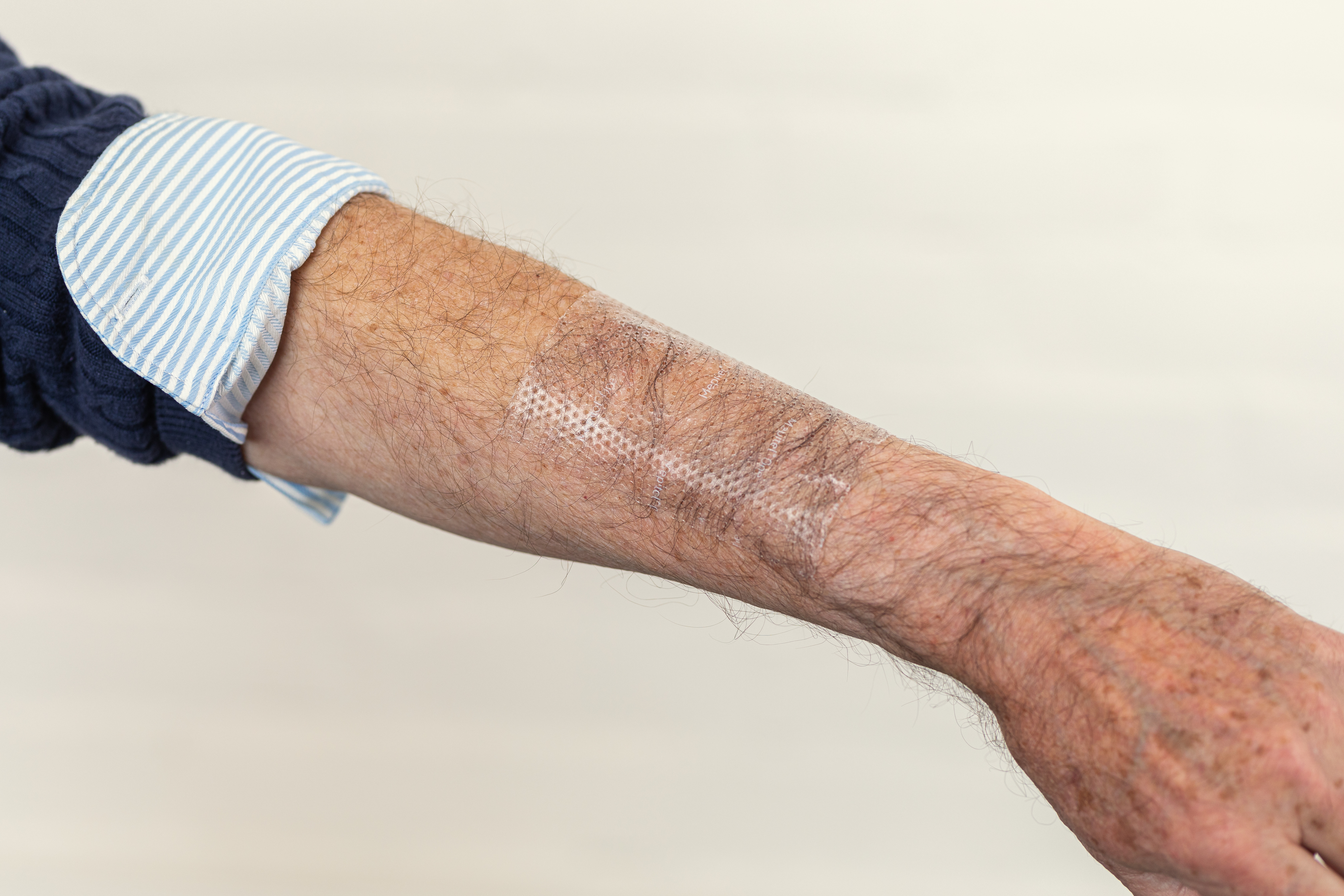 Mepitel One 7,5 x 10 cm