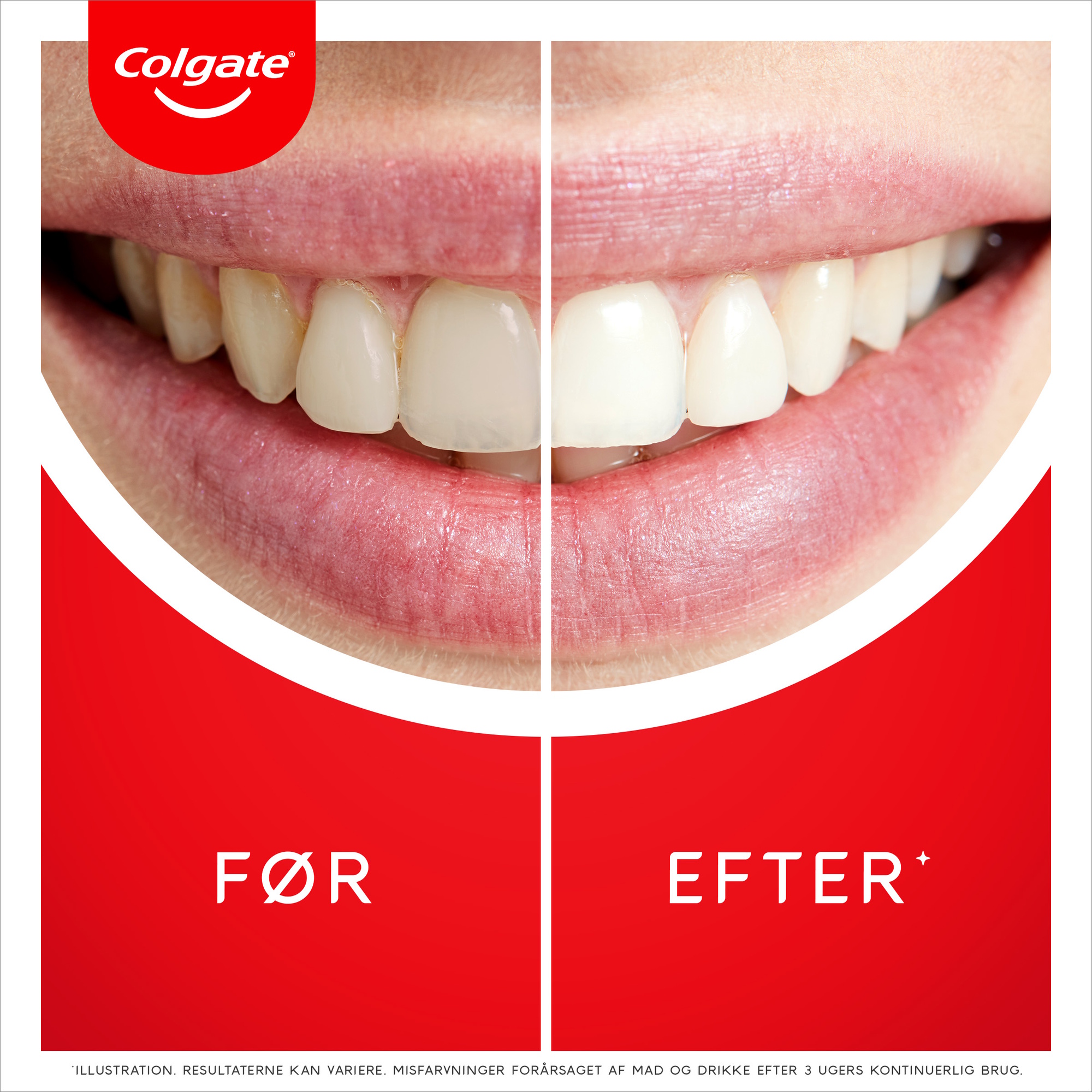 Colgate Tandpasta Max White Ultra Active Foam 75 ml.